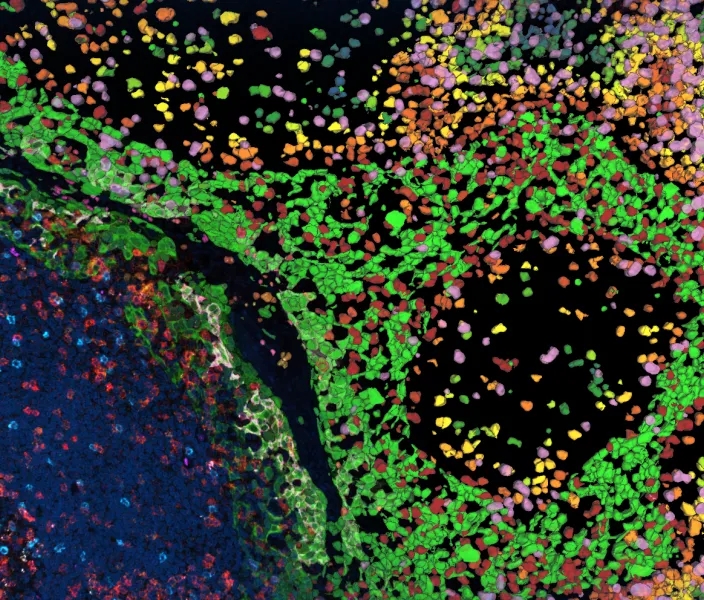 Danaher microscopy image of colored cells in human tonsil tissue, illustrating laboratory science; source image by Danaher