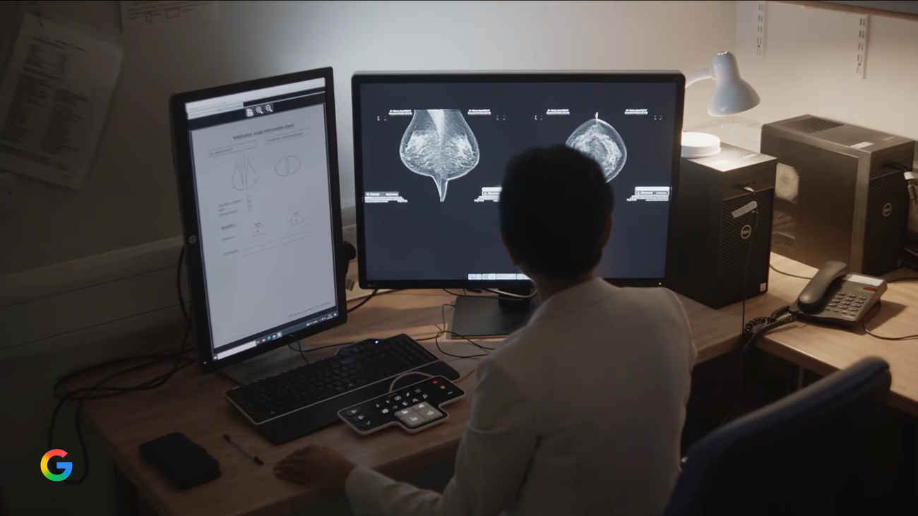 Google — mammography AI research feature image