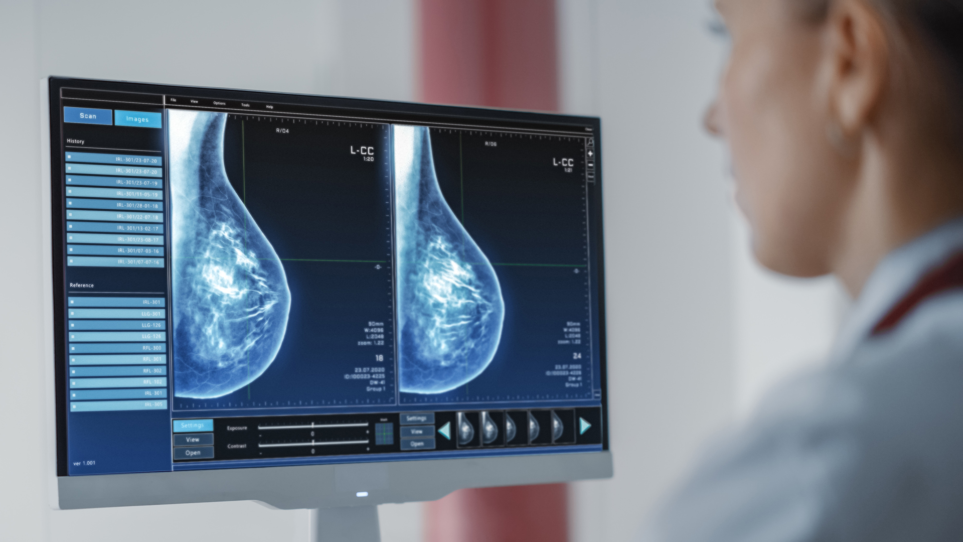 Medical imaging visual used in NVIDIA’s breast cancer AI report.